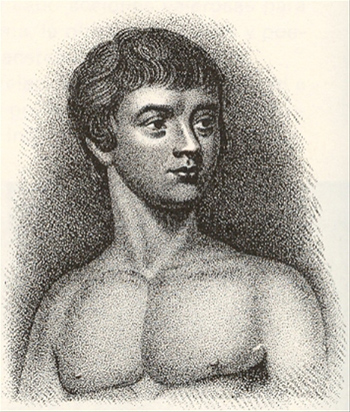 Victor de Aveyron, niño encontrado en 1798 que mostraba síntomas de TEA