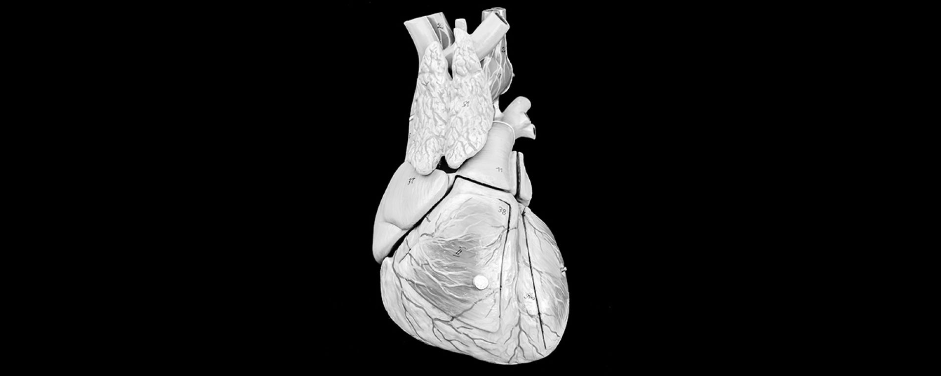 Cardiología Intervencionista y Hemodinamia