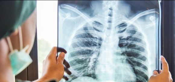 La EPOC: el asesino silencioso