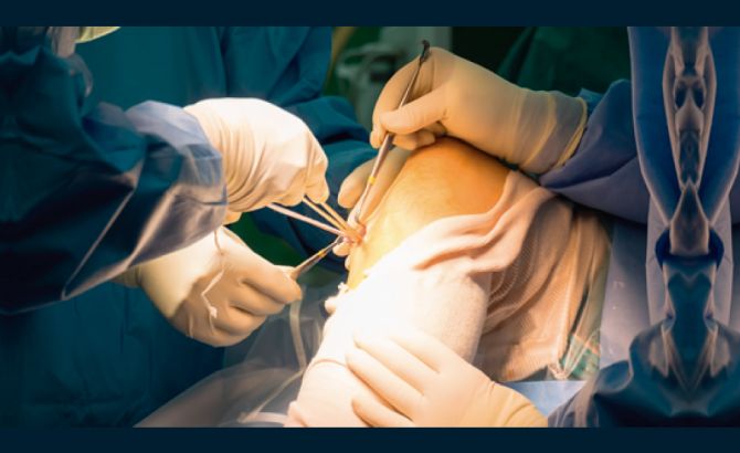 Especialización en Cirugía Vascular Periférica y Angiología